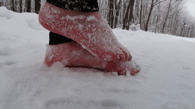 FeetExtreme - Frostbitten Feet (FULL HD MP4 version)