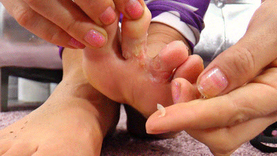 Princess Serena - Foot fungus - I have it and YOU want it!