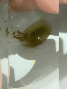 LadyVikkiWet - Diarrhoea