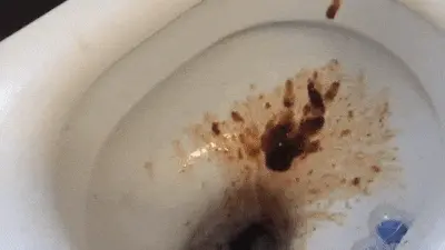Poop and Pee Extreme Fantasy - Massive diarrhea